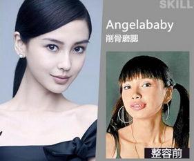 長沙整容爆料案件最新,揭開醫美行業潛規則與維權困境